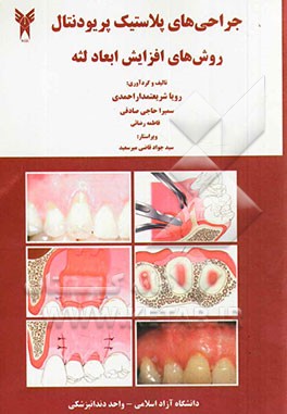 جراحیهای پلاستیک پریودنتال: روشهای افزایش ابعاد لثه