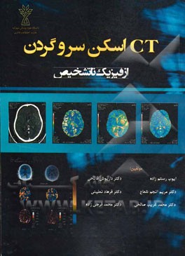 ‌CT اسکن سر و گردن، از فیزیک تا تشخیص