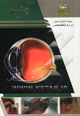 مجموعه چشم مرجع 93