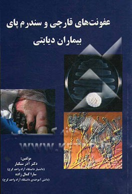 عفونت‌های قارچی و سندرم پای بیماران دیابتی