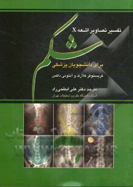 تفسیر تصاویر اشعه X شکم برای دانشجویان پزشکی