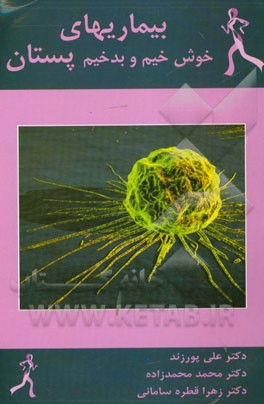 بیماریهای خوش‌خیم و بدخیم پستان