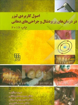 اصول کاربردی لیزر در درمان‌های پریودنتال و جراحی‌های دهانی