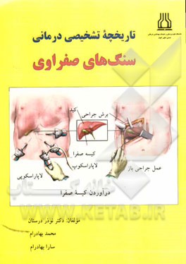 تاریخچه تشخیصی درمانی سنگ‌های صفراوی