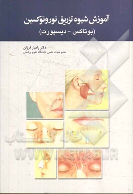 آموزش شیوه تزریق نوروتوکسین (بوتاکس - دیسپورت)