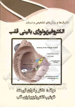 الکتروفیزیولوژی بالینی قلب: تکنیک‌ها و روش‌های تشخیص و درمان