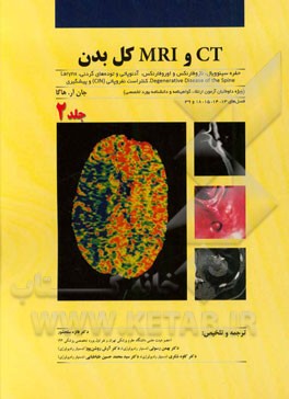 CT و MRI کل بدن: حفره سینوویال، نازوفارنکس و اوروفارنکس، آدنوپاتی و توده‌های گردنی، ...