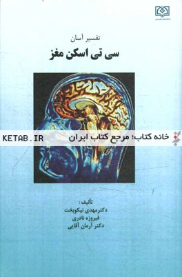 تفسیر آسان سی‌تی‌ اسکن مغز