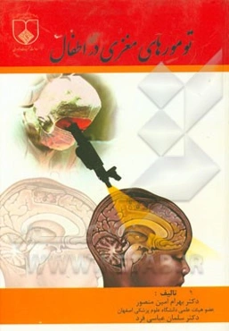 تومورهای مغزی در اطفال