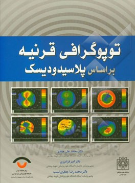 توپوگرافی قرنیه بر اساس پلاسیدودیسک