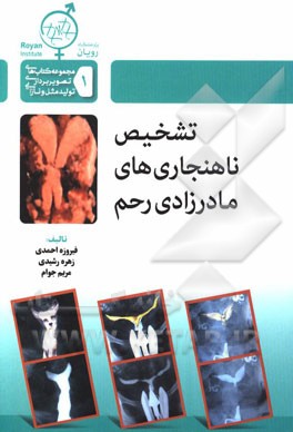 تشخیص ناهنجاری‌های مادرزادی رحم