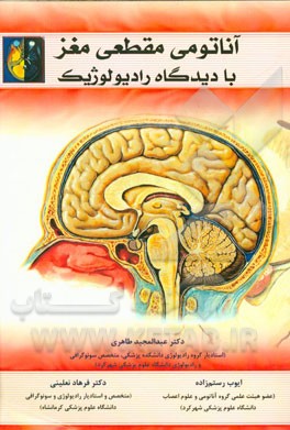 آناتومی مقطعی مغز با دیدگاه رادیولوژیک