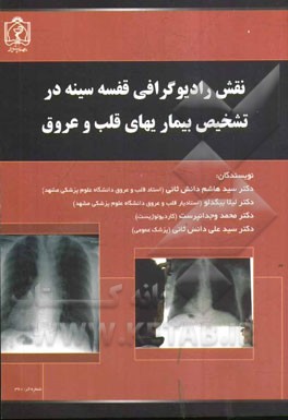 نقش رادیوگرافی قفسه سینه در تشخیص بیماریهای قلب و عروق