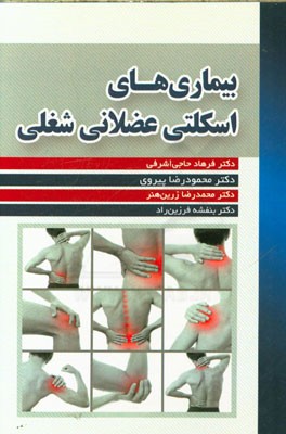 بیماری‌های اسکلتی عضلانی شغلی