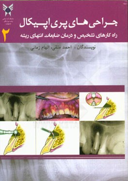 جراحی پری‌اپیکال