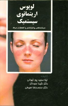 لوپوس اریتماتوی سیستمیک (SLE): درماندگی روان‌شناختی و اضطراب مرگ