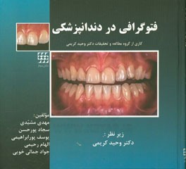 فتوگرافی در دندانپزشکی
