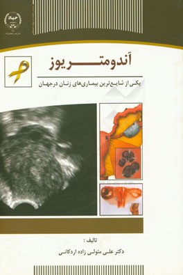 آندومتریوز یکی از شایع‌ترین بیماری‌های زنان در جهان