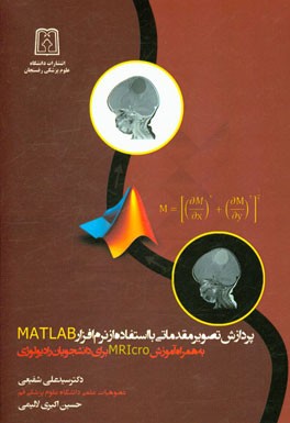پردازش تصویر مقدماتی با استفاده از نرم‌افزار MATLAB بهمراه آموزش MRIcro برای دانشجویان رادیولوژی