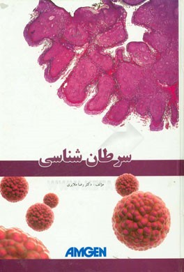 سرطان‌شناسی