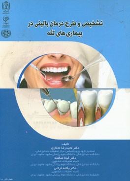 تشخیص و طرح درمان بالینی در بیماری‌های لثه