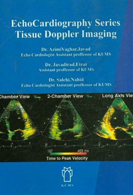 سری اکوکاردیوگرافی - تیشیوداپلر