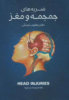 ضربه‌های جمجمه و مغز