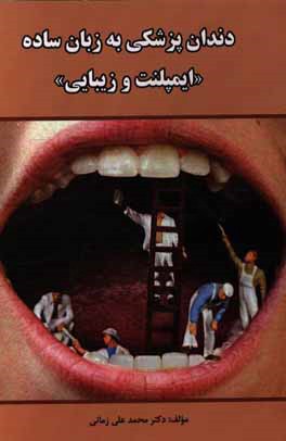 دندان‌پزشکی به زبان ساده "ایمپلنت و زیبایی"