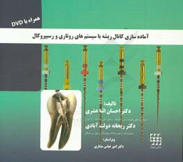 آماده‌سازی کانال ریشه با سیستم روتاری و رسیپروکال