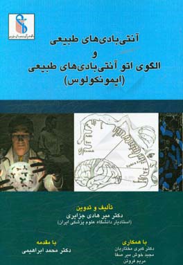 آنتی‌بادی‌های طبیعی و الگوی اتو آنتی‌بادی‌های طبیعی (ایمونکولوس)
