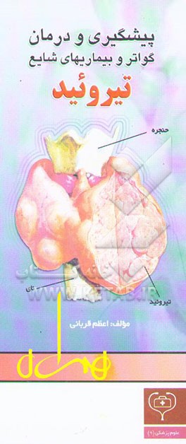 پیشگیری و درمان گواتر و بیماریهای شایع تیروئید