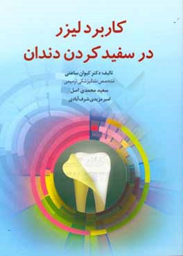 کاربرد لیزر در سفید کردن دندان