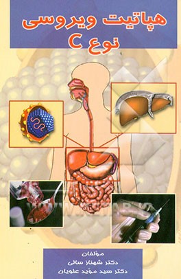 هپاتیت ویروسی نوع "C"