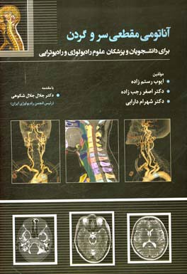 آناتومی مقطعی سر و گردن برای دانشجویان و پزشکان علوم رادیولوژی و رادیوتراپی