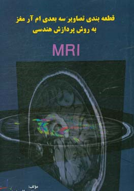 قطعه‌بندی تصاویر سه‌بعدی ام آر آی مغز به روش پردازش هندسی