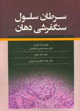 سرطان سلول سنگفرشی دهان