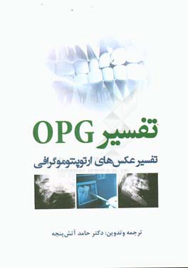 تفسیر OPG: تفسیر عکس‌های ارتوپنتوموگرافی