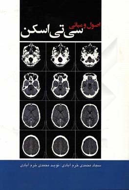 اصول و مبانی سی تی اسکن