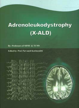 Adrenoleukodystrophy (X - ALD)