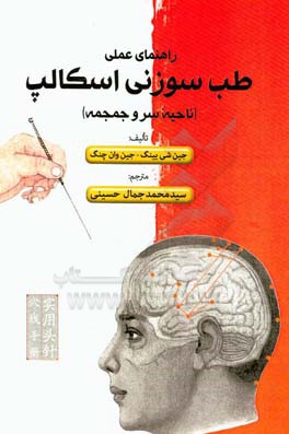 راهنمای عملی طب سوزنی اسکالپ (ناحیه سر و جمجمه)