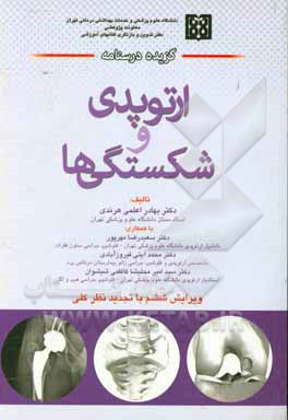 گزیده درسنامه ارتوپدی و شکستگی‌ها