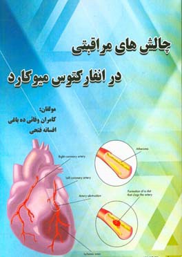 چالش‌های مراقبتی در انفارکتوس میوکارد