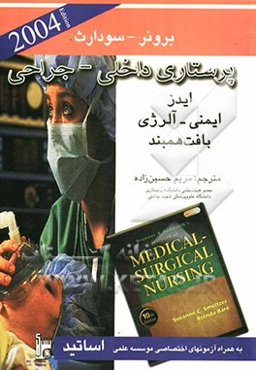 ایدز، ایمنی - آلرژی بافت همبند