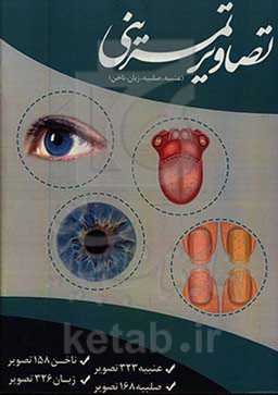 تصاویر تمرینی (عنبیه، صلبیه، زبان، ناخن) ...