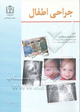 جراحی اطفال