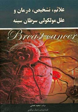 علائم، تشخیص، درمان و علل مولکولی سرطان سینه