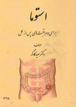 راهنمای استوما: جراحی و مراقبت‌های پس از عمل