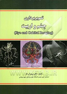 تصویربرداری چشم و اربیت (Eye and orbital imaging)