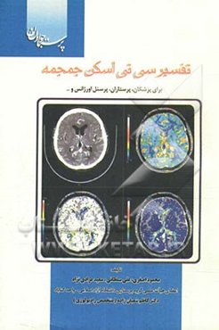 تفسیر سی ‌تی اسکن جمجمه: برای پزشکان، پرستاران و پرسنل اورژانسها