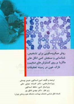 روش میکروسکوپی برای تشخیص، شناسایی و سنجش کمی انگل‌های مالاریا بر روی گسترش‌های ضخیم و نازک خون در زمینه تحقیقات
